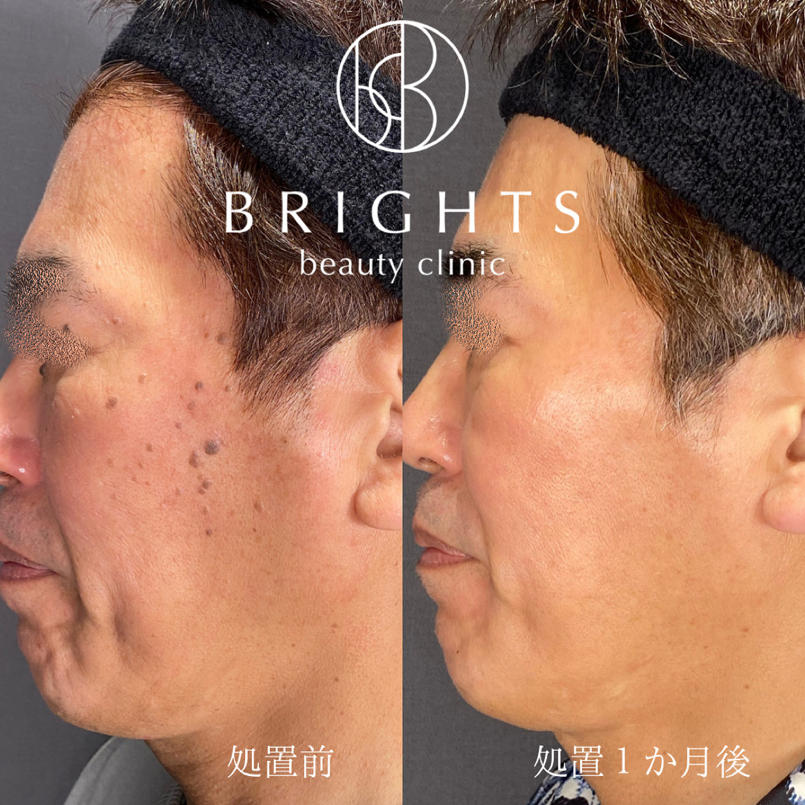 B0E6F610-BCB6-4F35-9B3B-3193E5446B60-2